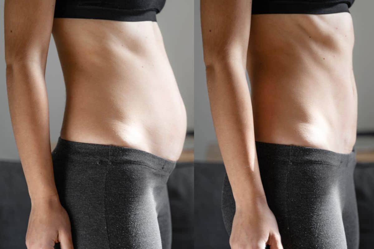 Post-Pregnancy: What Happens to Your Abdominal Muscles After Birth Edinburgh