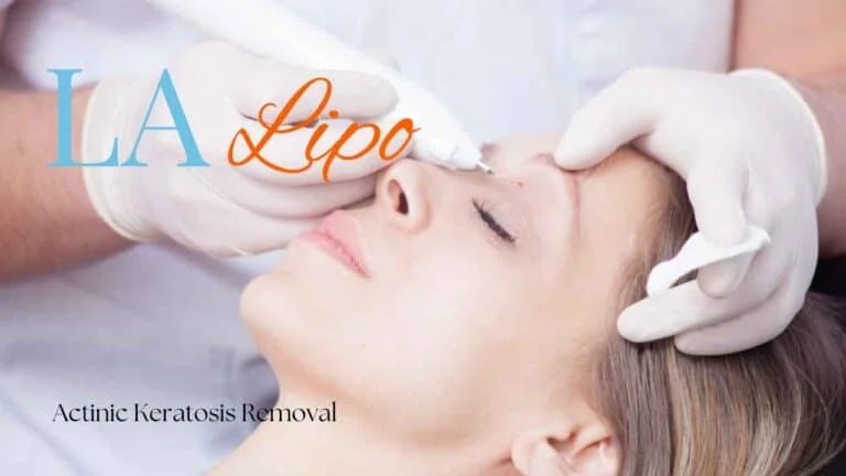 Woman receiving Actinic Keratosis Removal Treatment Edinburgh