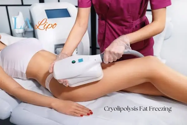 Woman receiving coolsculpting Edinburgh treatment on her thighs