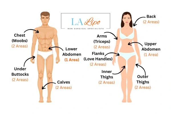 LA LIPO Cryolipolysis Areas Edinburgh