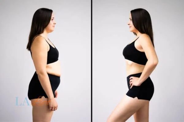 link between body image and mental health Edinburgh