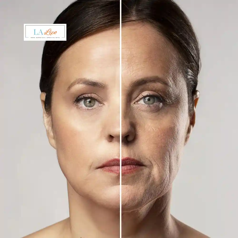 How Can You Tell If Non-Surgical Skin Tightening Is Right for You Edinburgh?