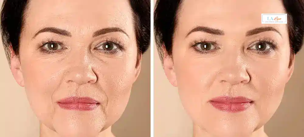 How Long Does It Take to See Results and How Long Do They Last Edinburgh?