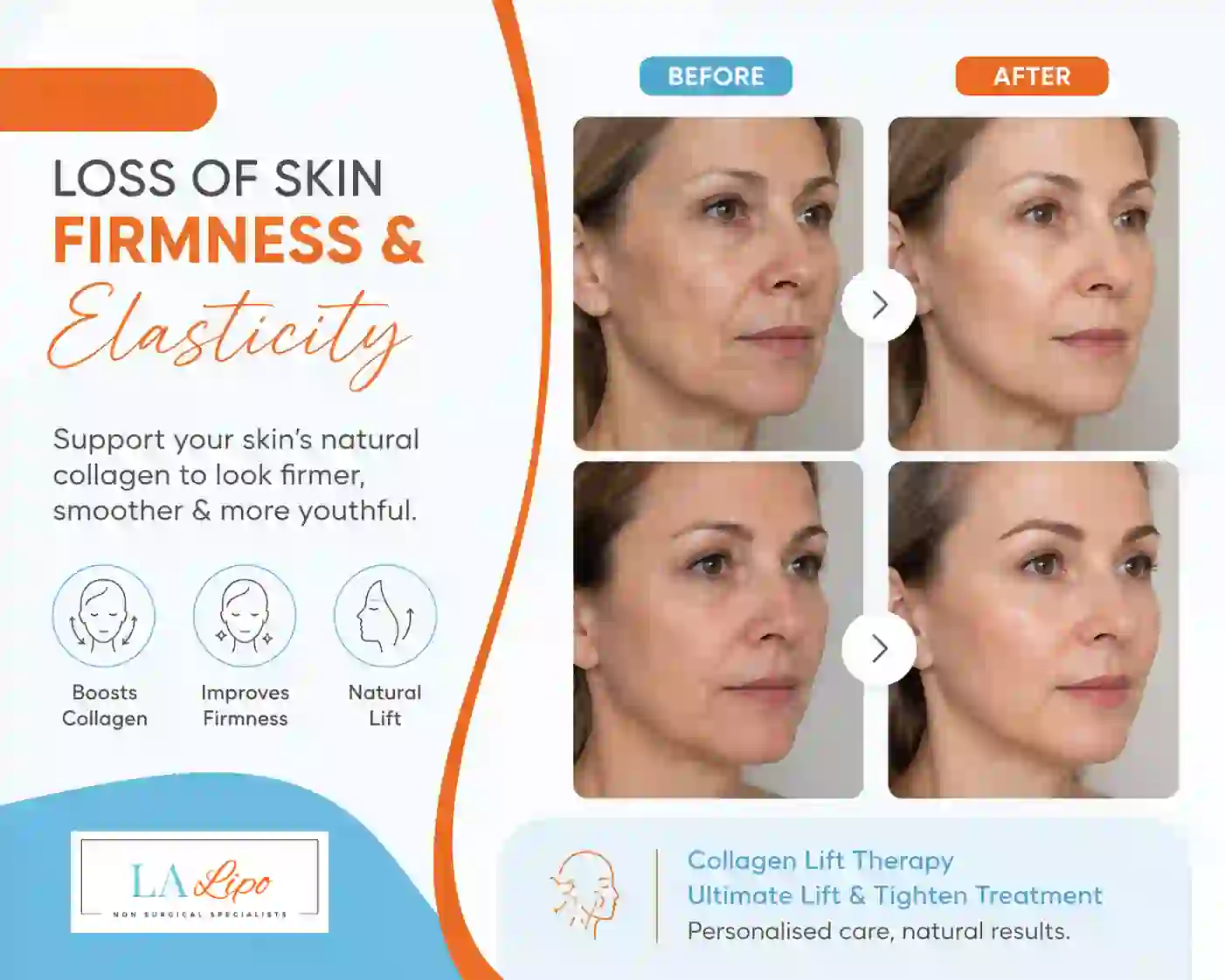 Sign #7: Loss of Skin Firmness and Elasticity Edinburgh